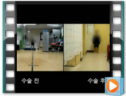 （术前/术后）步态 9