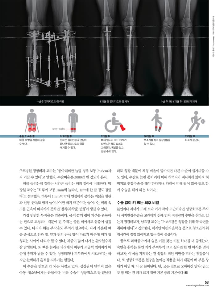 Post-surgery recovery process - Infographic 6
